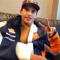 Marc Márquez maradandó fogyatékosságtól tartott